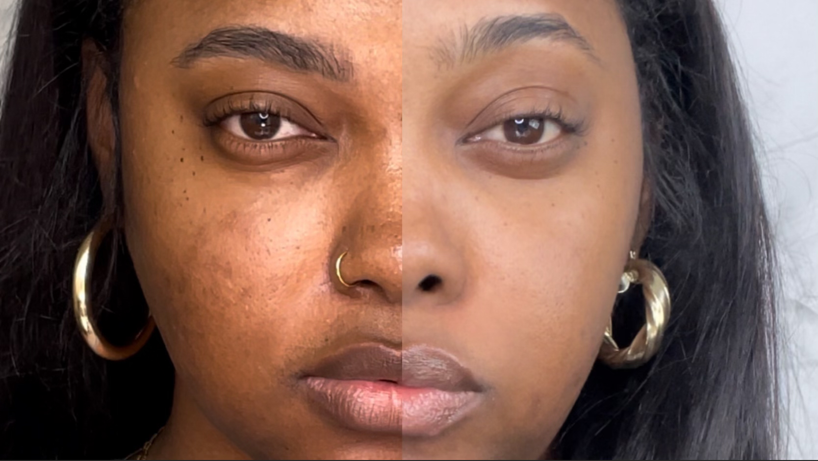 Morgan Ashley before and after skin barrier repair &mdash; melanin-rich skin dark skin hyperpigmentation